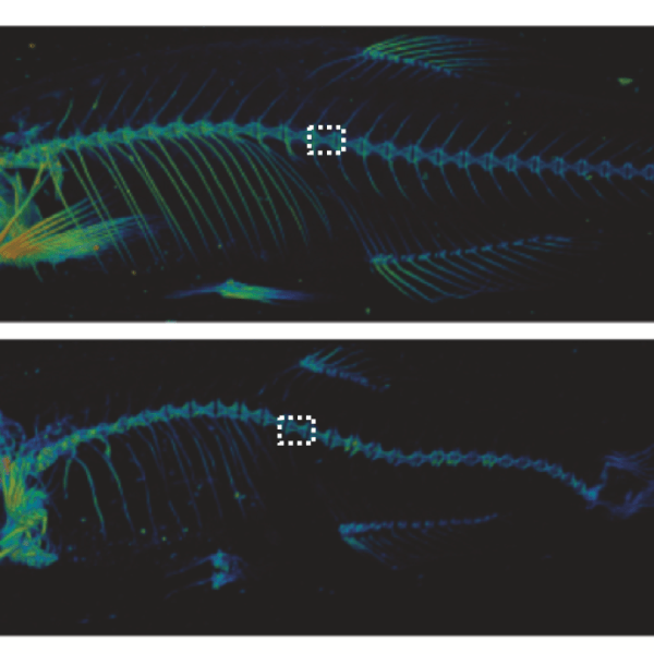 Morphology analysis of bone&nbsp;malformation
